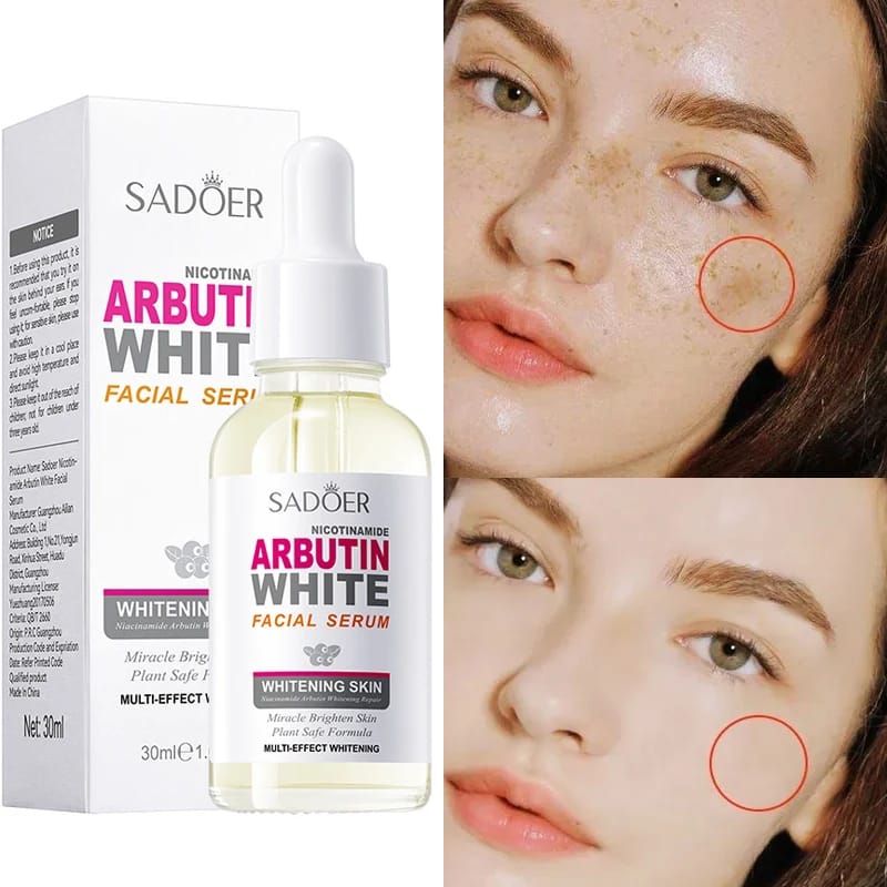 Arbutin la solucion Despigmentante Facial SADOER.