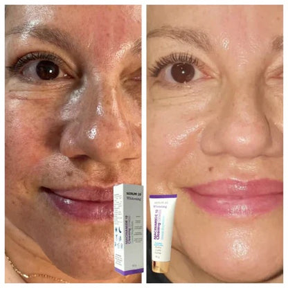Niacinamida jabon y serum10 antiarrugas.